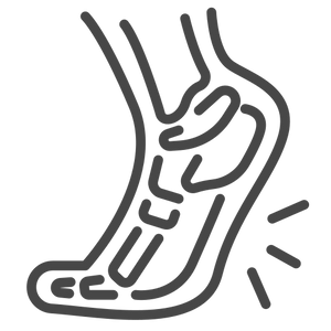 Plantarni fascitis